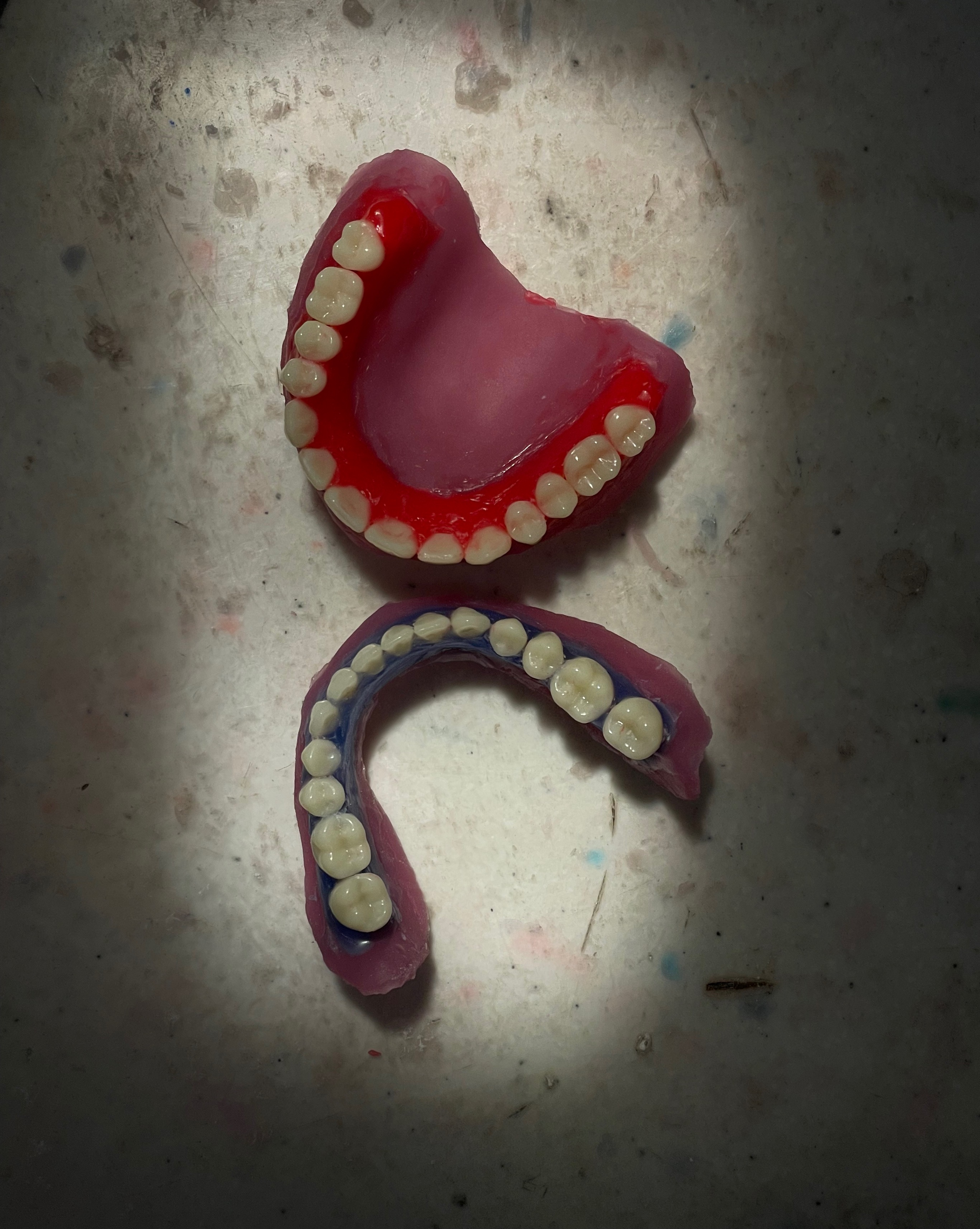 First Complete Denture