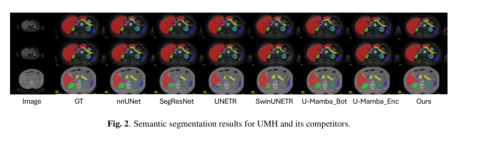 Enhancing medical image segmentation via heat conduction equation
